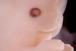 fetus-42day.JPG