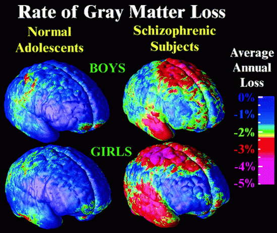  male-vs-female-brain