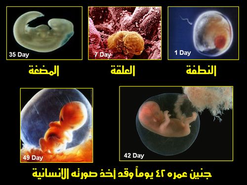  :    embryo_human_001.JPG