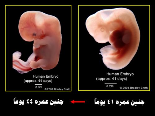  :    embryo_human_006.JPG